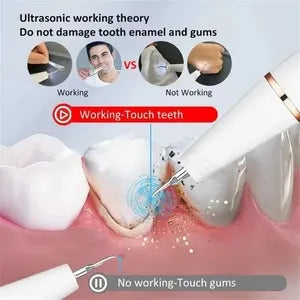 Smart Ultrasonic Teeth Cleaner